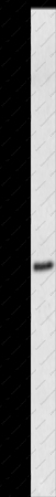 MMP26 Polyclonal Antibody - 1