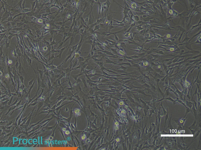 Rat Brain Fibroblast Complete Medium - 3