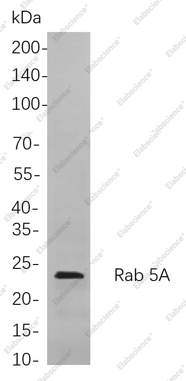 Recombinant Rab 5A Monoclonal Antibody - 1