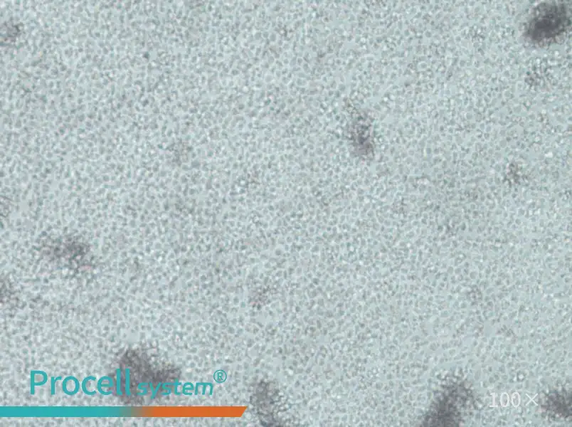 IM-9 Cell Complete Medium - 1