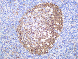 Recombinant PBK Monoclonal Antibody - 2