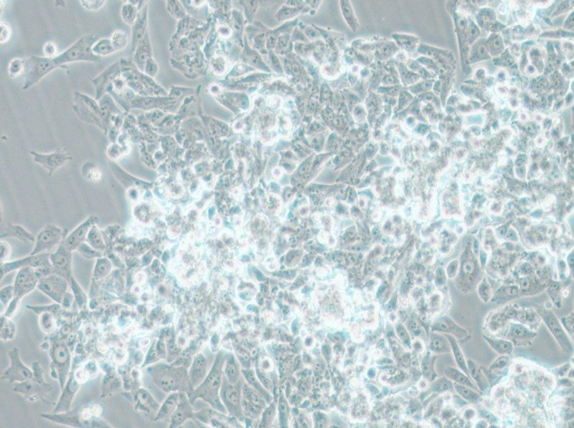 MES-SA Cell Complete Medium - 5