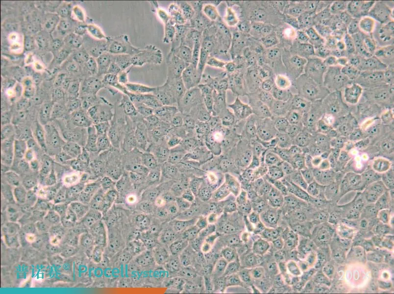 B-CPAP [BC-PAP; BCPAP]（人甲状腺乳头状癌细胞）-细胞系-武汉普诺赛生命科技有限公司