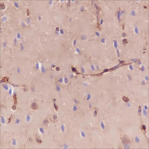 Recombinant Galectin-1 Monoclonal Antibody - 3