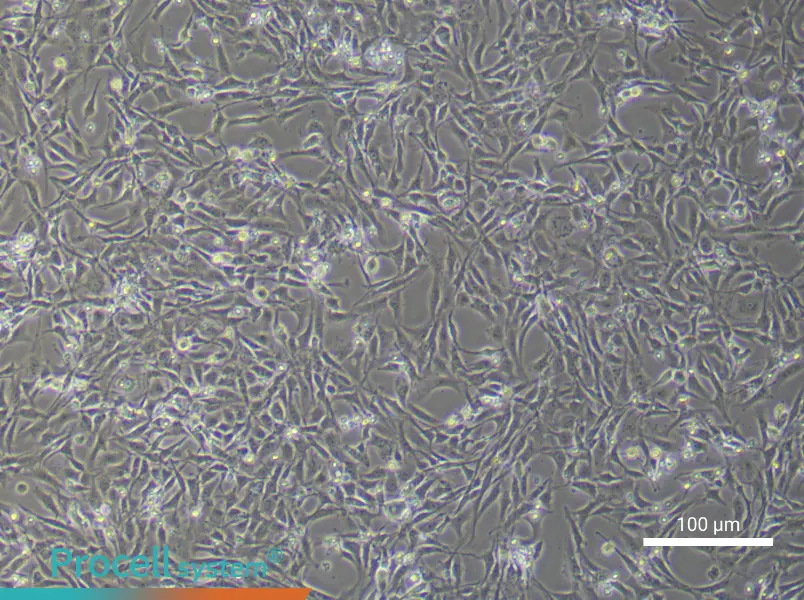 Rat Corpus Cavernosum Smooth Muscle Cells - 1