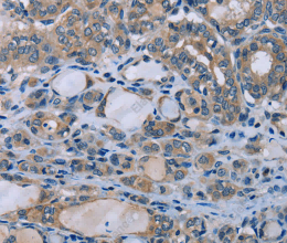 HOMER1 Polyclonal Antibody - 3