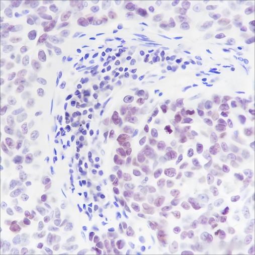 Recombinant ING5 Monoclonal Antibody - 3