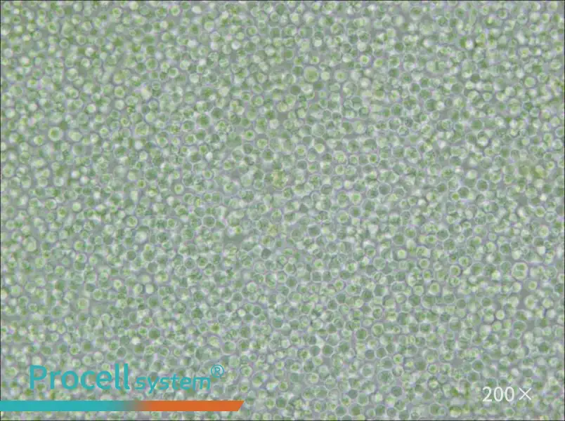 SU-DHL-4 Cell Complete Medium - 4