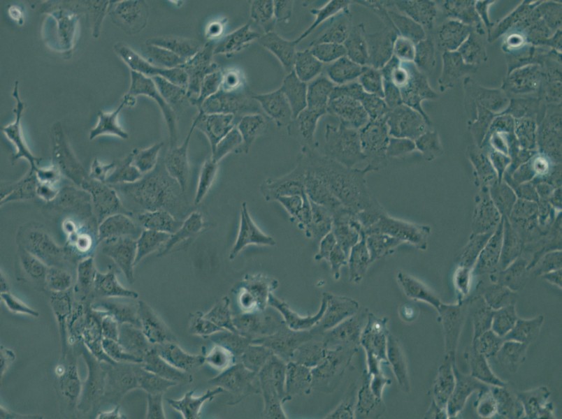 SK-OV-3 Cell Complete Medium - small - 6