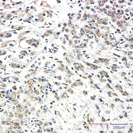 Recombinant KIF5B Monoclonal Antibody - 2