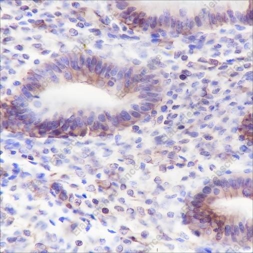 Recombinant ALOX15 Monoclonal Antibody - 2