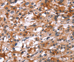 Glucagon Receptor Polyclonal Antibody - 2