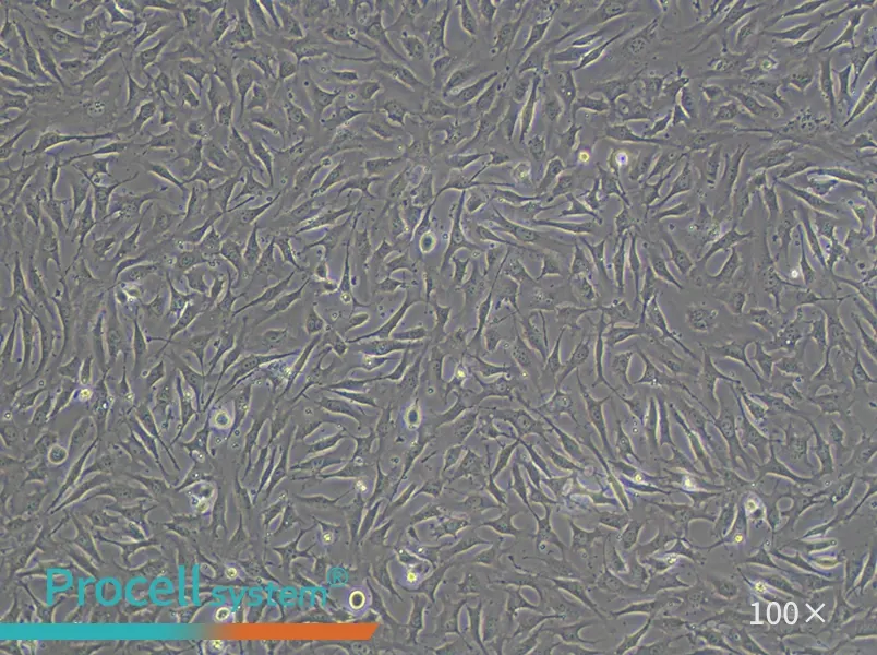EA.hy926 Cell Complete Medium - 1