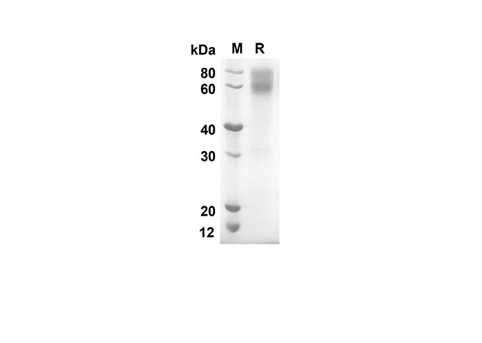Recombinant Human CD30 Protein(Fc Tag)-产品推荐-1