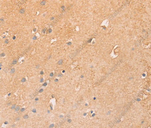 CCL16 Polyclonal Antibody - 3