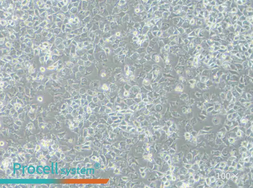 92-1 [Human uveal melanoma] Cell Complete Medium92-1 [Human uveal melanoma] Cell Complete Medium - 3