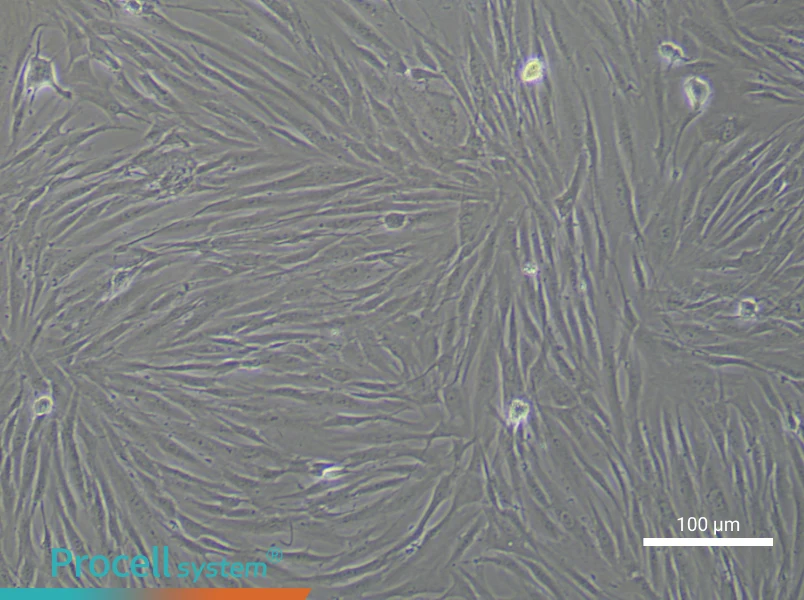 Human Chondrocyte Complete Medium - 1