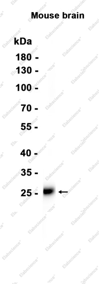 Recombinant TPPP Monoclonal Antibody - 2