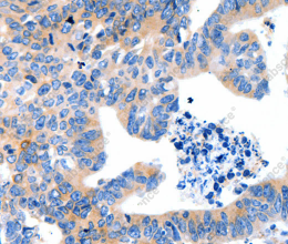 LRPAP1 Polyclonal Antibody - 2