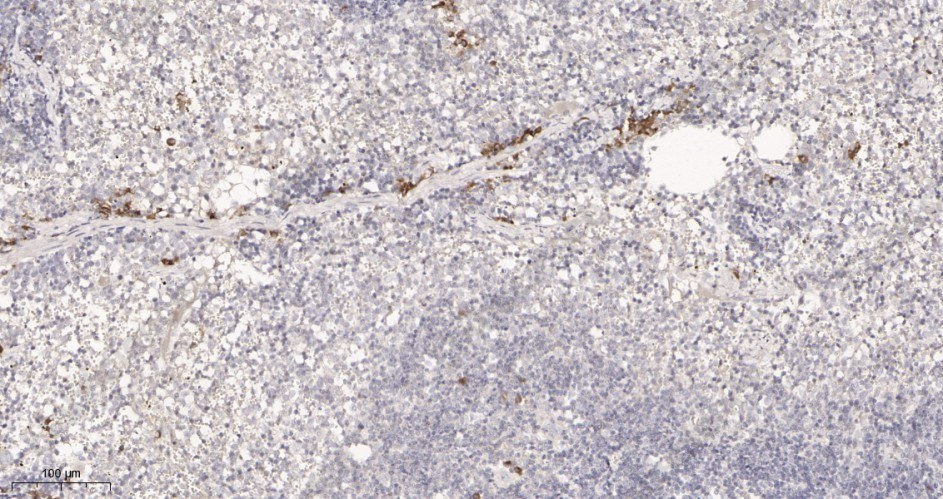 Recombinant IL18 Monoclonal Antibody - 3