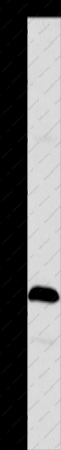 TSLP Polyclonal Antibody - 1