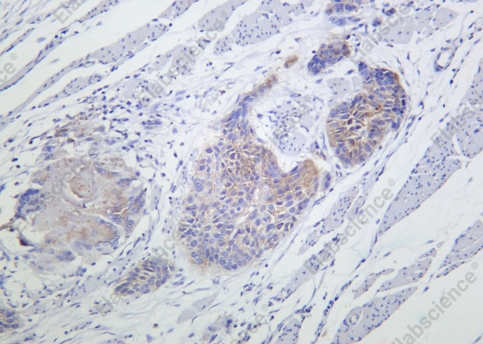 Recombinant ATG3 Monoclonal Antibody - 2