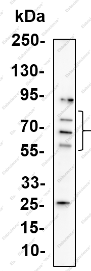 Recombinant Ikaros Monoclonal Antibody - 1