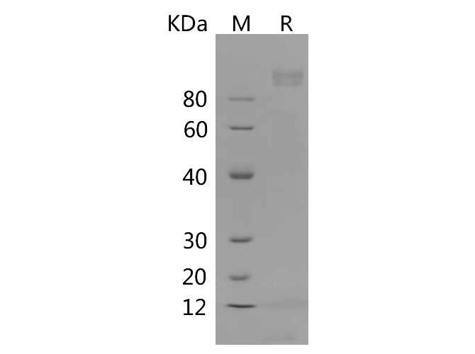 Recombinant Mouse GM-CSF Protein(His Tag)-产品推荐-1
