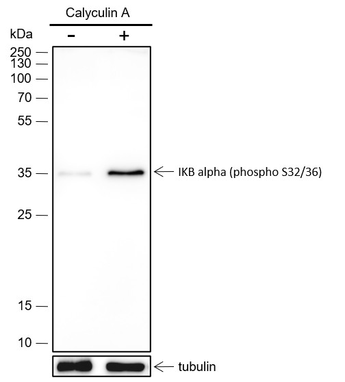Recombinant Phospho-IKB alpha (Ser32, Ser36) Monoclonal Antibody - 2