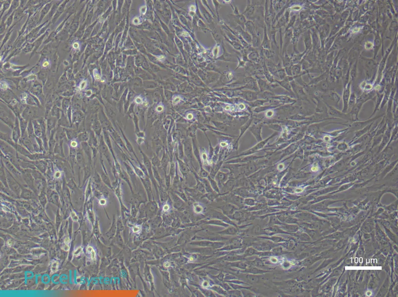 Human Lung Fibroblast (Primary cell immortalization) Complete Medium - 1