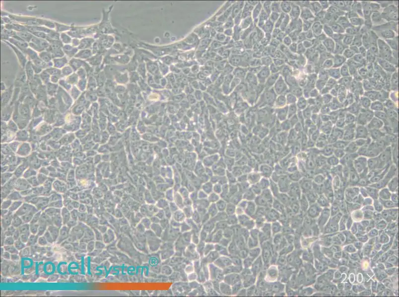 Detroit 562 Cell Complete Medium - 5