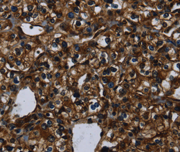 KLK14 Polyclonal Antibody - 3
