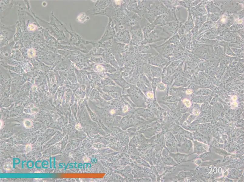 TTA1 Cell Complete Medium - small - 6