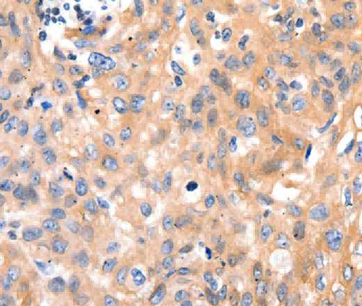 MYL9 Polyclonal Antibody - 3