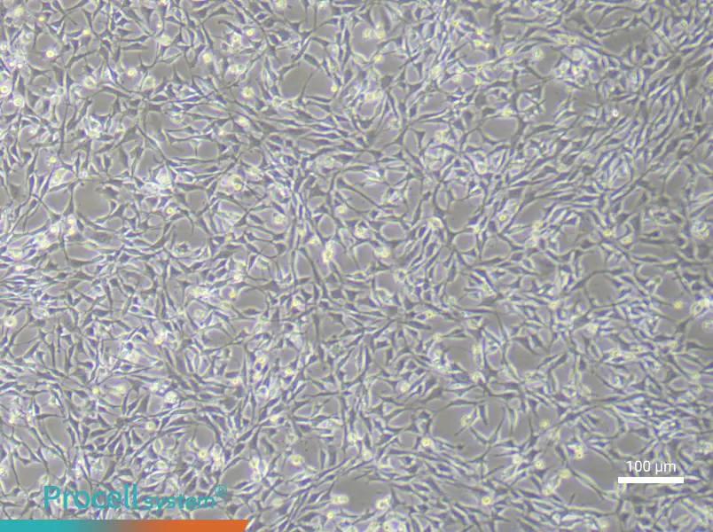 Rat Bone Marrow Mesenchymal Stem (Primary cell immortalization) Cell Complete Medium - 1