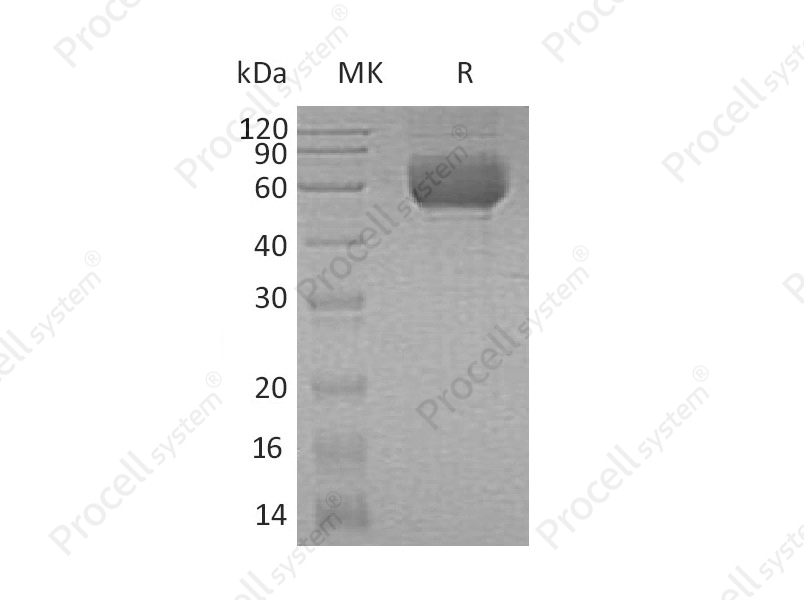 ST2/IL1RL1, Human, Recombinant