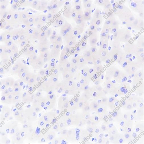 Recombinant PAP Monoclonal Antibody - 3