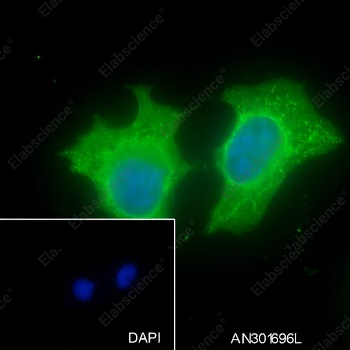 Recombinant IRF6 Monoclonal Antibody - 2