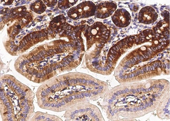 Recombinant MAP2 Monoclonal Antibody - small - 3