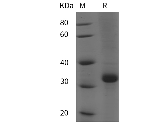 Recombinant Rat IL-6 Protein(Sumo Tag)-产品推荐-1