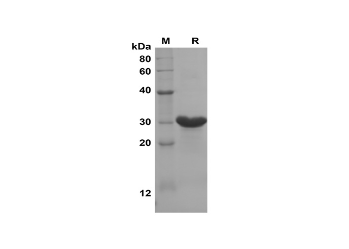 Recombinant Human TGF beta 1 Protein(His Tag)-产品推荐-2