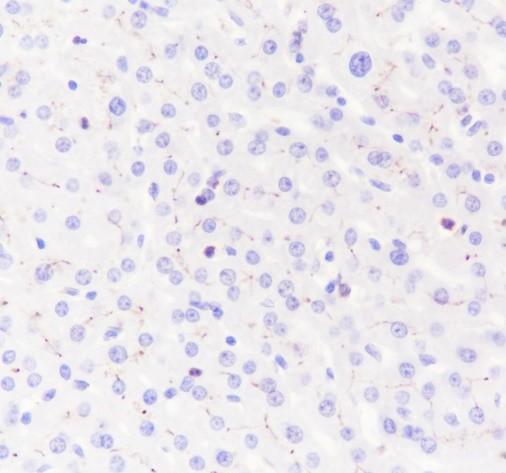 Recombinant Glypican-3 Monoclonal Antibody - small - 3