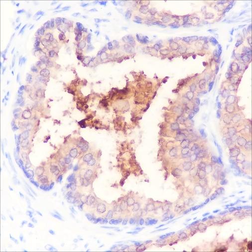 Recombinant PSA Monoclonal Antibody - small - 2