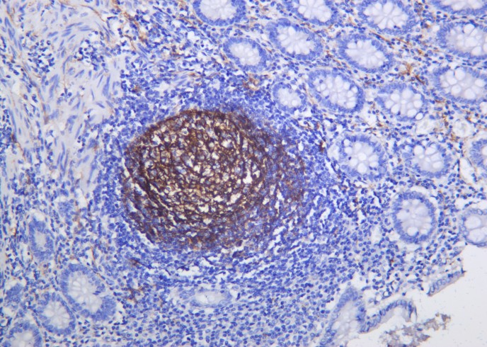 Recombinant NGFR p75 Monoclonal Antibody - small - 2