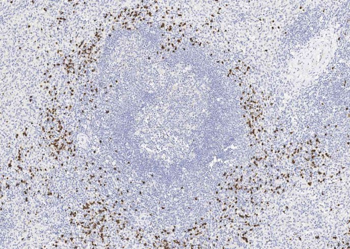 Recombinant Lipocalin-2/LCN2 Monoclonal Antibody - small - 3