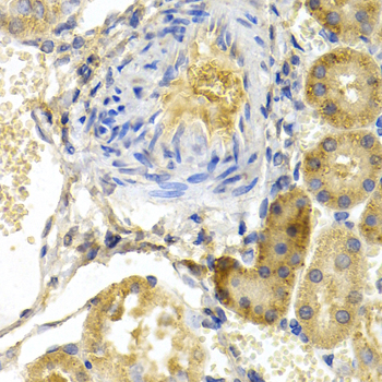 Immunohistochemistry of paraffin-embedded Rat kidney using BAD Polyclonal Antibody at dilution of  1:200 (40x lens).