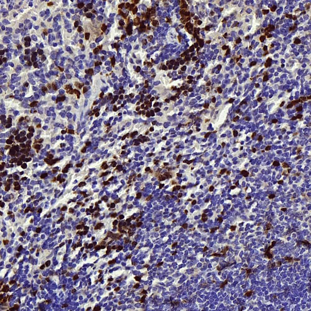 Immunohistochemistry analysis of paraffin-embedded mouse spleen  using Survivin Polyclonal Antibody at dilution of 1:300.