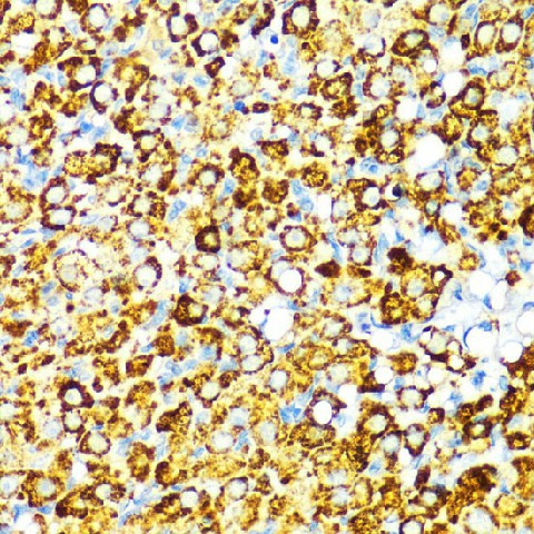 Immunohistochemistry of paraffin-embedded Rat ovary using PBEF / NAMPT Polyclonal Antibody at dilution of  1:100 (40x lens).