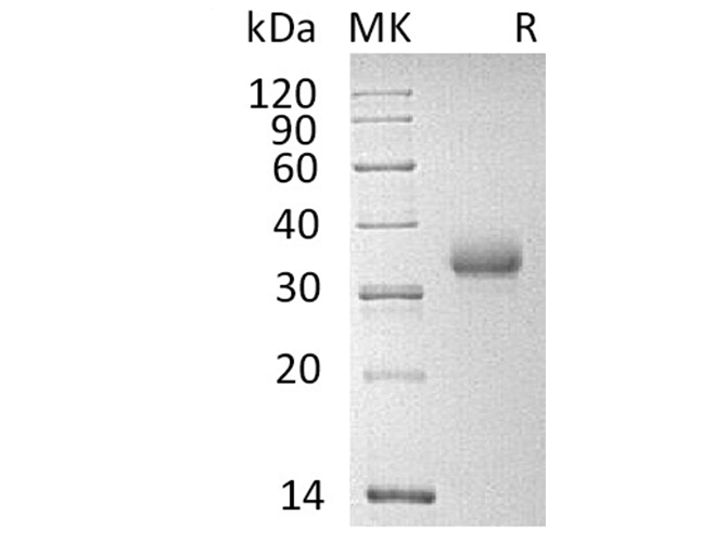 Recombinant Human CD2 Protein (His Tag)