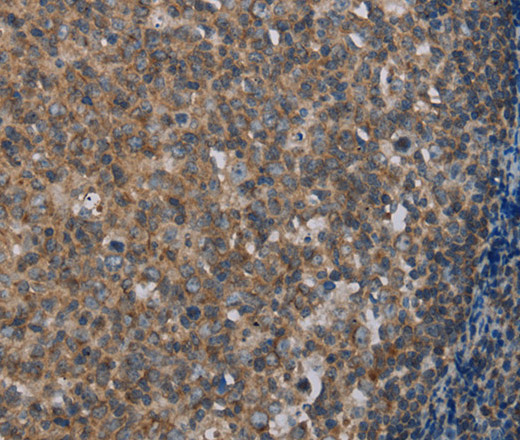 Immunohistochemistry of paraffin-embedded Human tonsil using MMP20 Polyclonal Antibody at dilution of 1:40